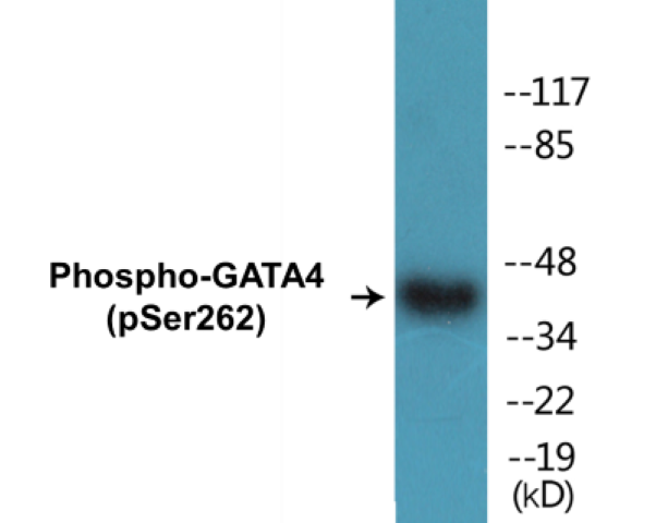 GATA4 (phospho Ser262) Cell Based ELISA Kit