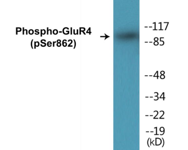 GluR4 (phospho Ser862) Cell Based ELISA Kit