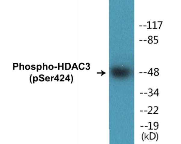 HDAC3 (phospho Ser424) Cell Based ELISA Kit