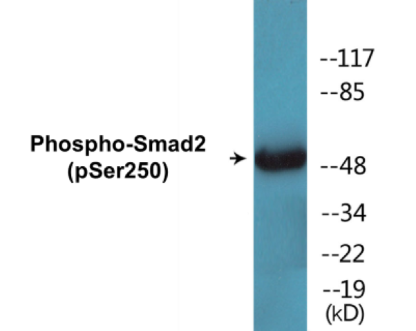 Smad2 (phospho Ser250) Cell Based ELISA Kit
