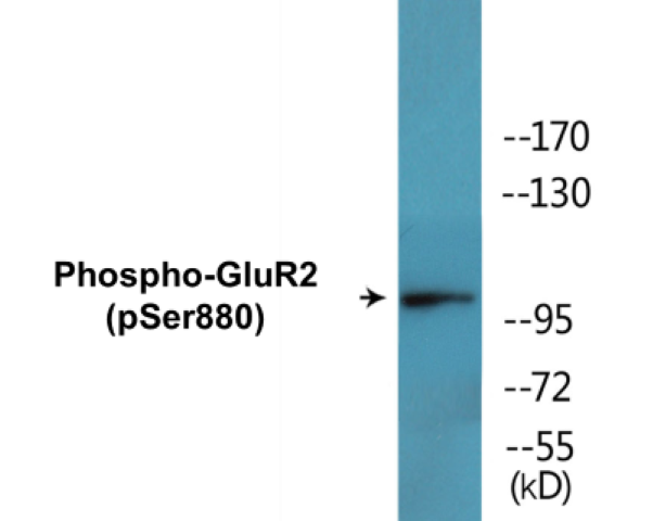 GluR2 (phospho Ser880) Cell Based ELISA Kit