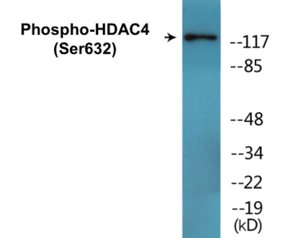 HDAC4 (phospho Ser632) Cell Based ELISA Kit
