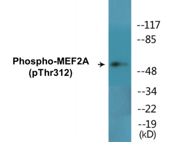MEF2A (phospho Thr312) Cell Based ELISA Kit
