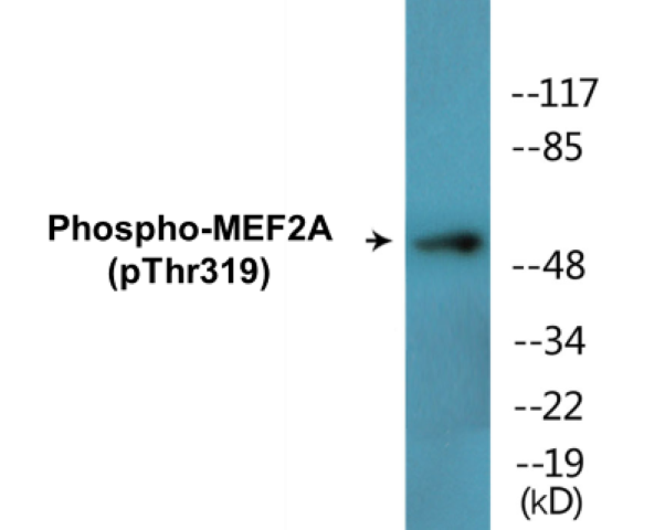 MEF2A (phospho Thr319) Cell Based ELISA Kit
