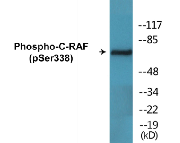C-RAF (phospho Ser338) Cell Based ELISA Kit