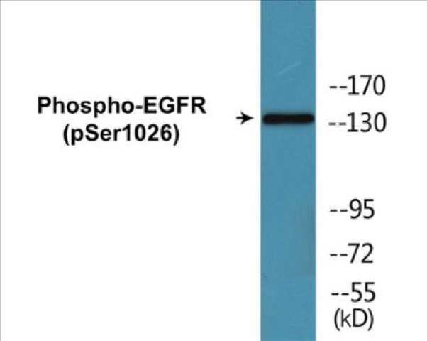 EGFR (phospho Ser1026) Cell Based ELISA Kit