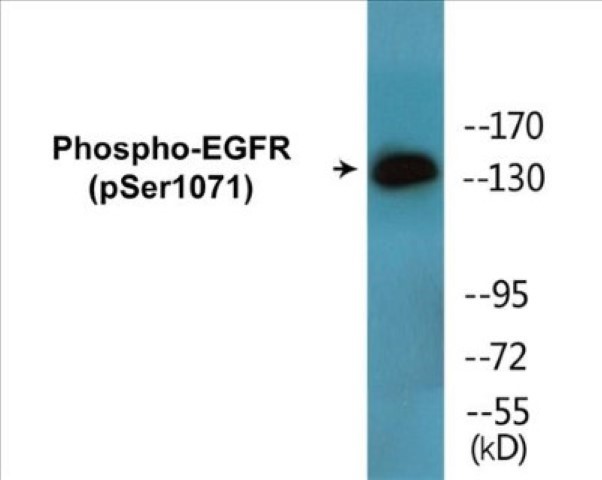 EGFR (phospho Ser1071) Cell Based ELISA Kit