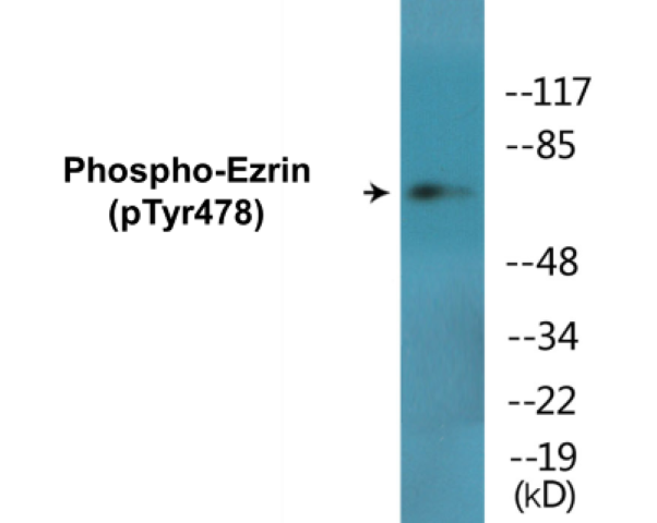 Ezrin (phospho Tyr478) Cell Based ELISA Kit