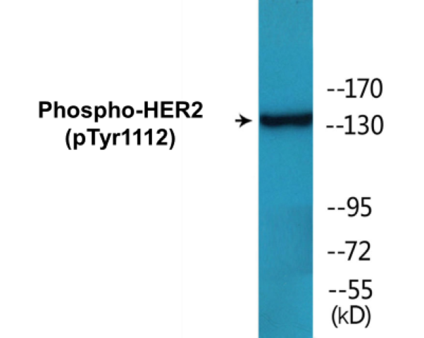 HER2 (phospho Tyr1112) Cell Based ELISA Kit