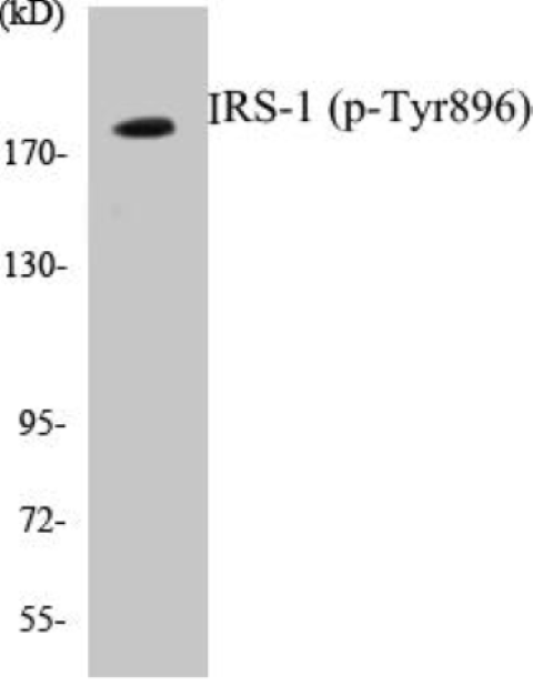 IRS-1 (phospho Tyr896) Cell Based ELISA Kit