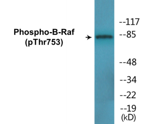 B-Raf (phospho Thr753) Cell Based ELISA Kit