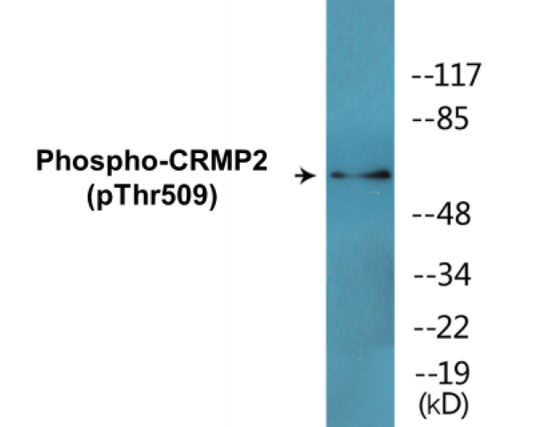 CRMP2 (phospho Thr509) Cell Based ELISA Kit