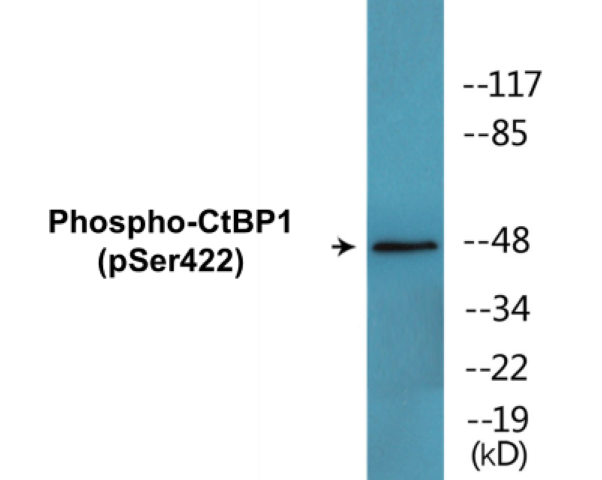 CtBP1 (phospho Ser422) Cell Based ELISA Kit