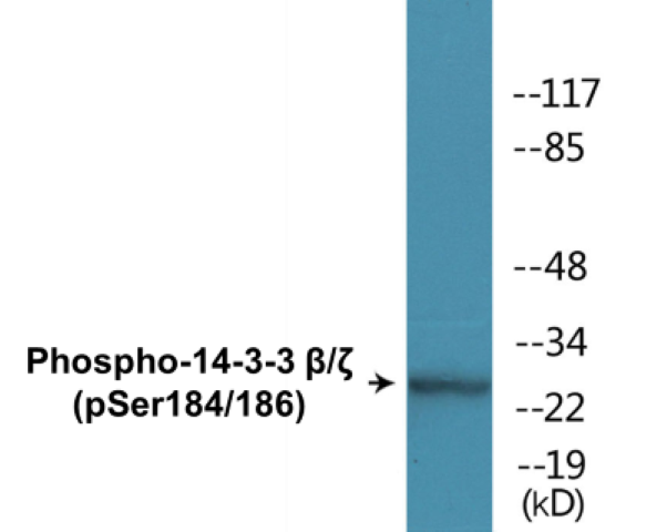 14-3-3 beta + zeta (phospho Ser184 + Ser186) Cell Based ELISA Kit
