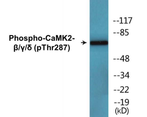 CaMK2 beta gamma delta (phospho Thr287) Cell Based ELISA Kit