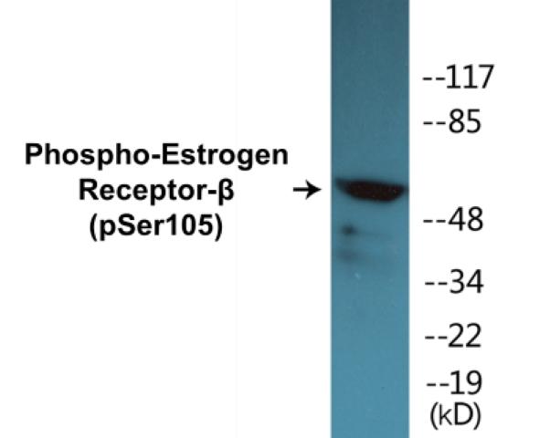 Estrogen Receptor beta (phospho Ser105) Cell Based ELISA Kit