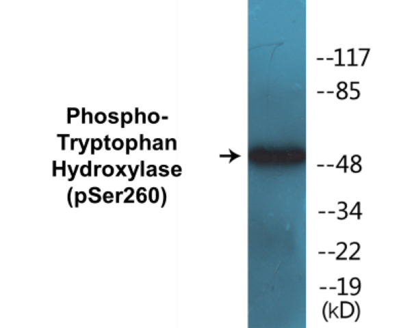 Tryptophan Hydroxylase (phospho Ser260) Cell Based ELISA Kit