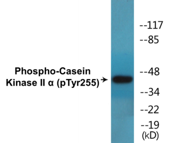 Casein Kinase II alpha (phospho Tyr255) Cell Based ELISA Kit