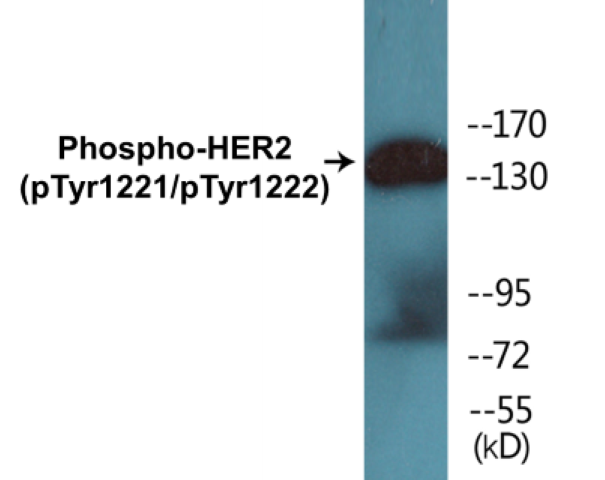 HER2 (phospho Tyr1221 + Tyr1222) Cell Based ELISA Kit