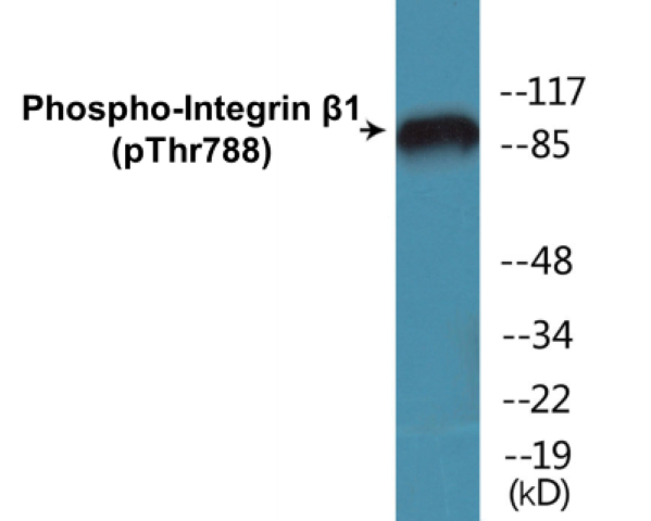 Integrin beta 1 (phospho Thr788) Cell Based ELISA Kit