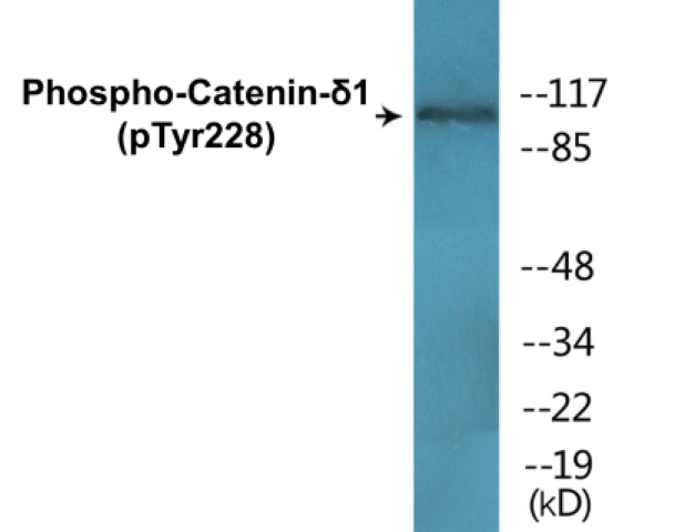 Catenin delta 1 (phospho Tyr228) Cell Based ELISA Kit