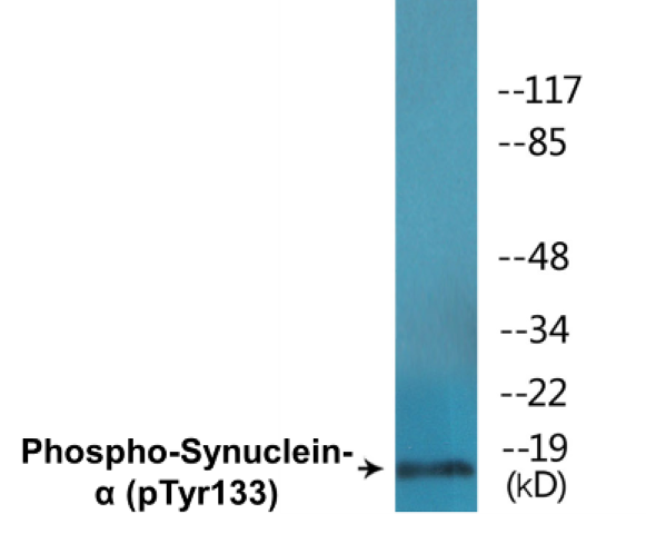 alpha Synuclein (phospho Tyr133) Cell Based ELISA Kit