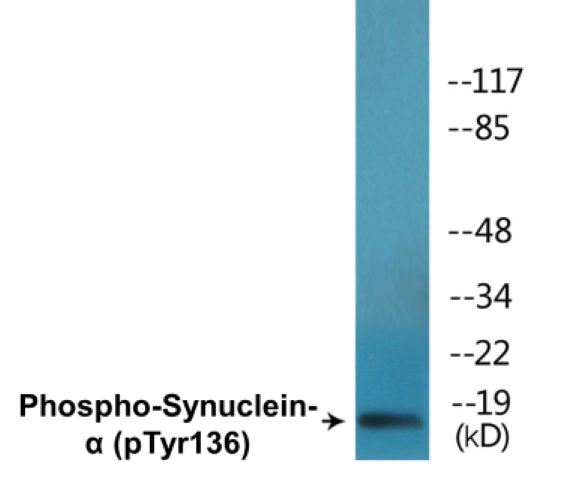 alpha Synuclein (phospho Tyr136) Cell Based ELISA Kit