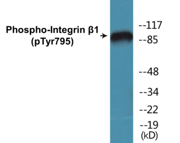 Integrin beta 1 (phospho Tyr795) Cell Based ELISA Kit