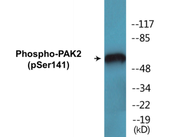 PAK2 (phospho Ser141) Cell Based ELISA Kit