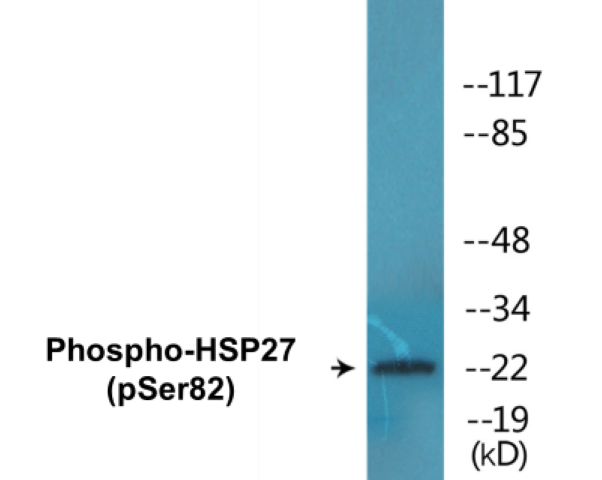 HSP27 (phospho Ser82) Cell Based ELISA Kit