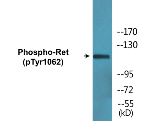 Ret (phospho Tyr1062) Cell Based ELISA Kit