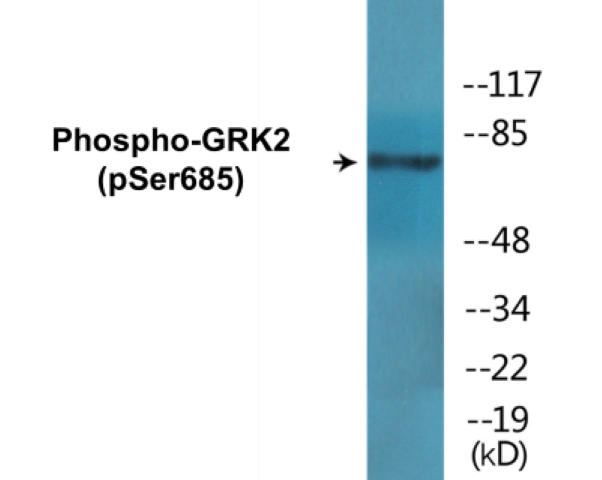 GRK2 (phospho Ser685) Cell Based ELISA Kit