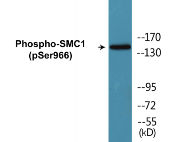 SMC1 (phospho Ser966) Cell Based ELISA Kit