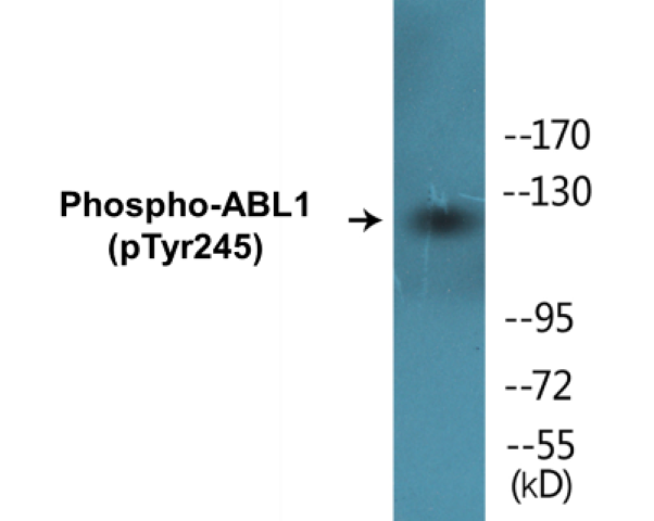 ABL1 (phospho Tyr245) Cell Based ELISA Kit