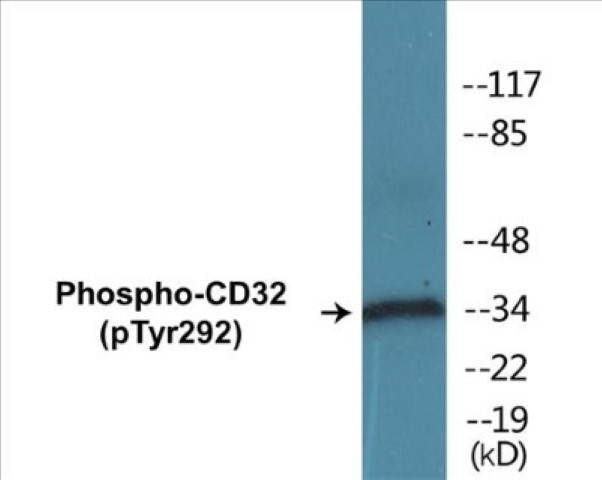 CD32 (phospho Tyr292) Cell Based ELISA Kit