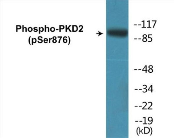 PKD2 (phospho Ser876) Cell Based ELISA Kit