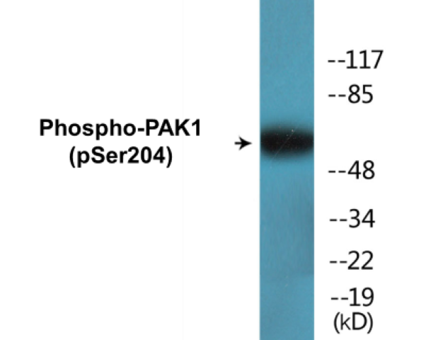 PAK1 (phospho Ser204) Cell Based ELISA Kit