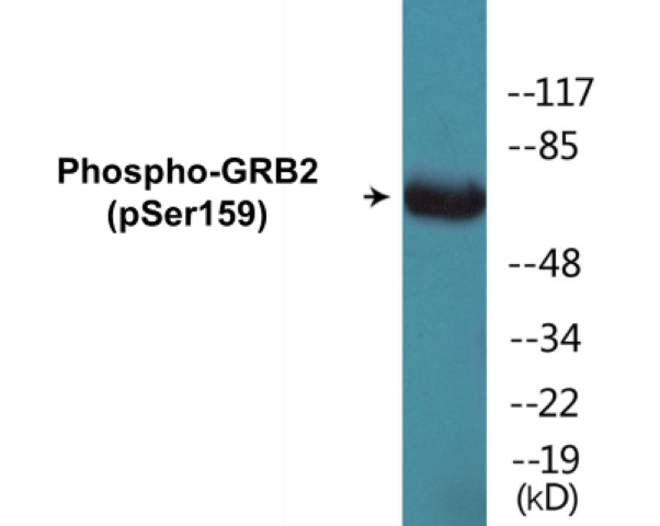 GRB2 (phospho Ser159) Cell Based ELISA Kit
