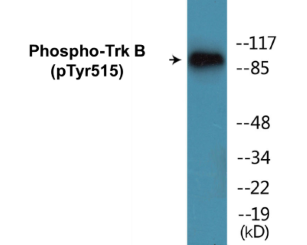 TrkB (phospho Tyr515) Cell Based ELISA Kit