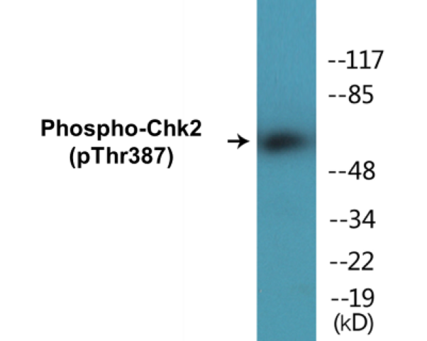 Chk2 (phospho Thr387) Cell Based ELISA Kit