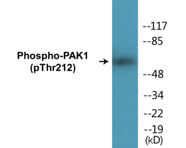 PAK1 (phospho Thr212) Cell Based ELISA Kit
