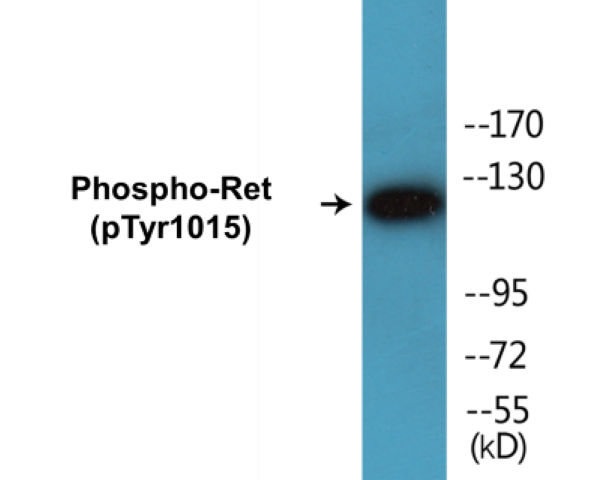 Ret (phospho Tyr1015) Cell Based ELISA Kit