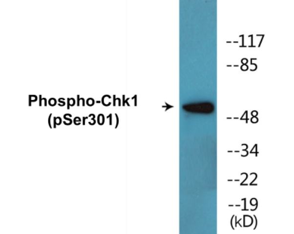 Chk1 (phospho Ser301) Cell Based ELISA Kit