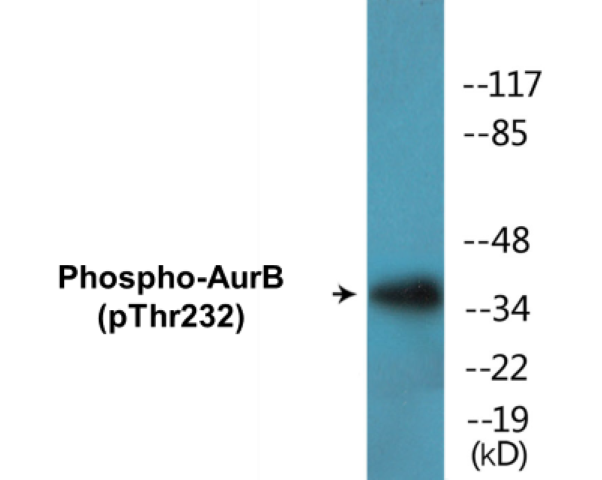 AurB (phospho Thr232) Cell Based ELISA Kit