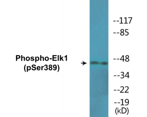 Elk1 (phospho Ser389) Cell Based ELISA Kit