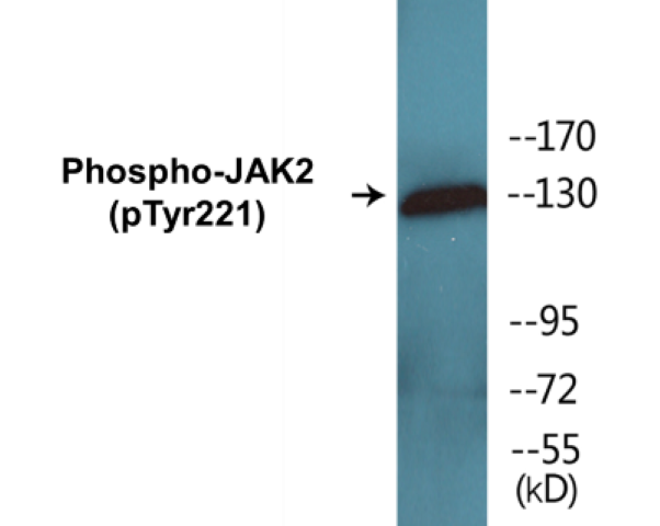 JAK2 (phospho Tyr221) Cell Based ELISA Kit