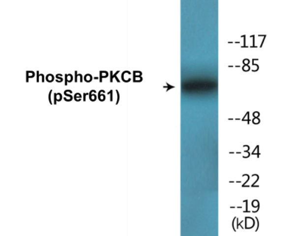 PKCB (phospho Ser661) Cell Based ELISA Kit
