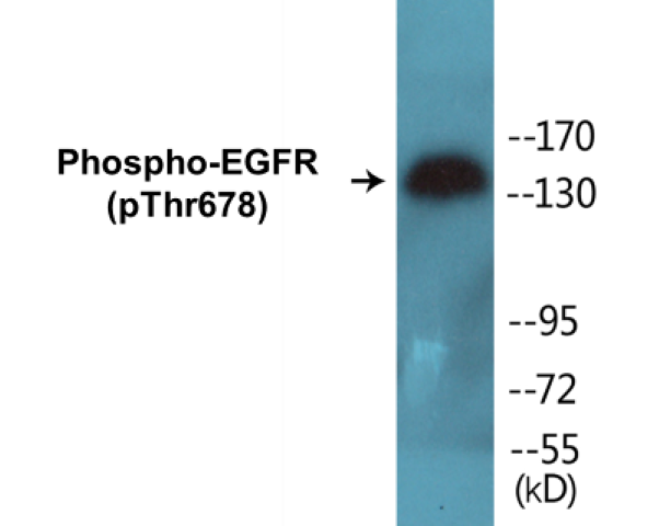 EGFR (phospho Thr678) Cell Based ELISA Kit