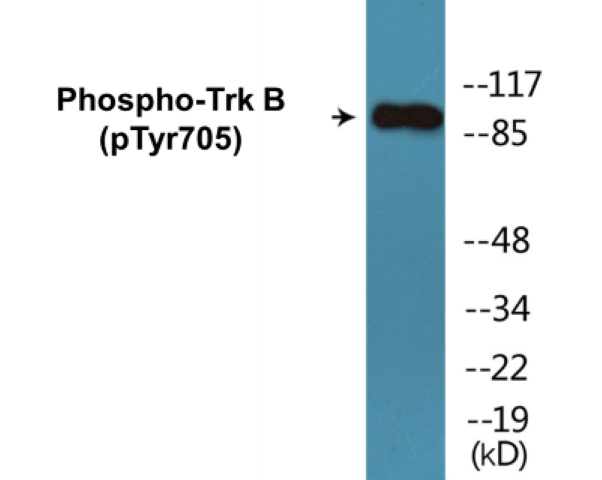 TrkB (phospho Tyr705) Cell Based ELISA Kit
