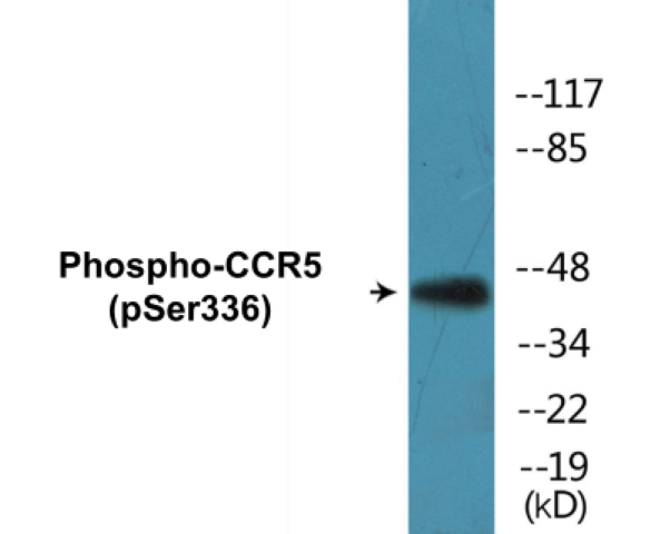 CCR5 (phospho Ser336) Cell Based ELISA Kit